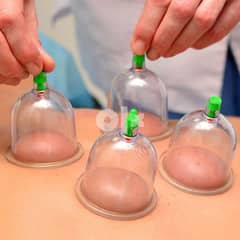 hijama tools for sell - cupping therapy tools