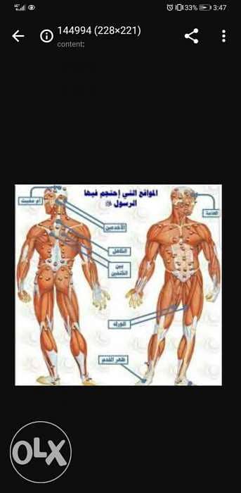 الحجامه نبويه ورقيه شرعيه
