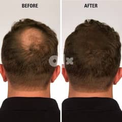 Magic Hair Filler for bald spots or for thinning hair . keratin fiber 0