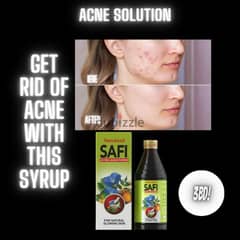 Acne solution