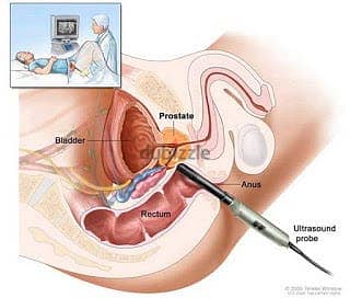 +27782749118 Medical Abortion Grains / Safe Abortion treatment 2